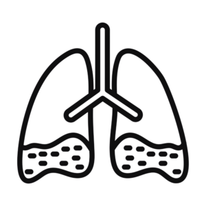 Asthma